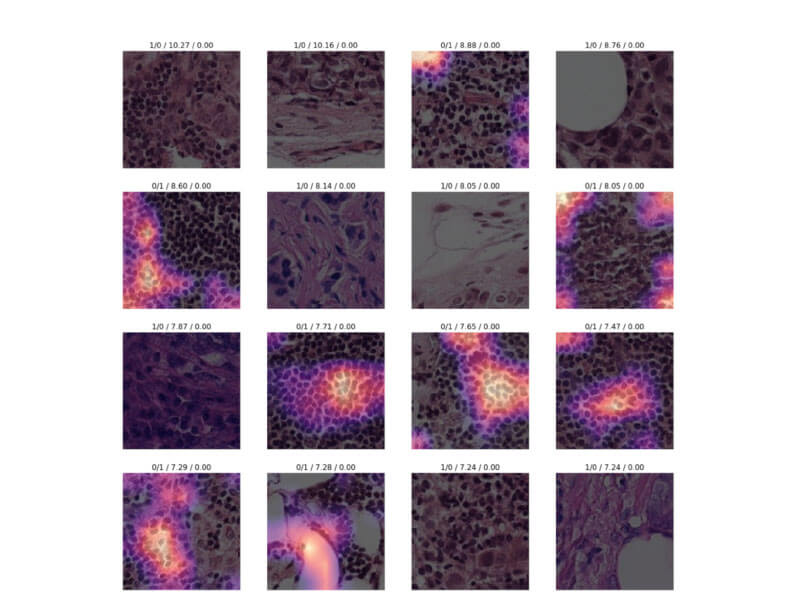 تشخیص سلول های سرطانی با دیپ لرنینگ